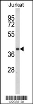 CCR3 Antibody (Center)