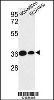 TAZ Antibody (N-term)