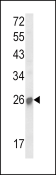 SOCS1 Antibody (N-term)