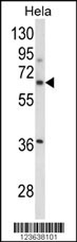 ITGBL1 Antibody (Center)