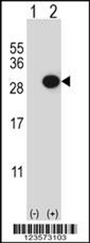 CTHRC1 Antibody (N-term)
