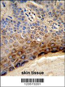 CTHRC1 Antibody (N-term)