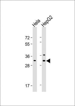 CTHRC1 Antibody (N-term)