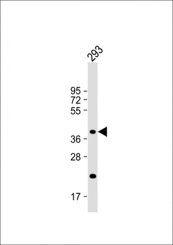 CSGALNACT2 Antibody (Center)