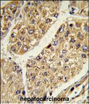 CSGALNACT2 Antibody (Center)