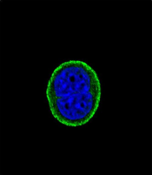 IL10RA Antibody (Center)