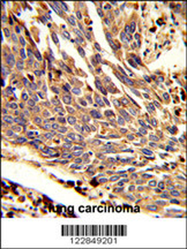 ARPC1B Antibody (Center)