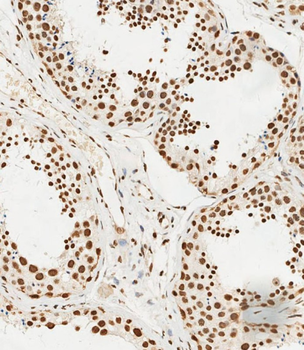 HSPA7 Antibody (Center)