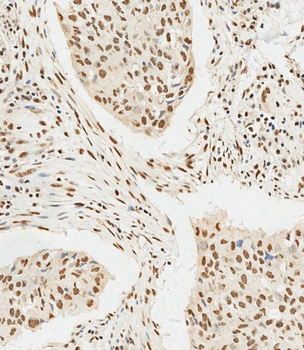 HSPA7 Antibody (Center)