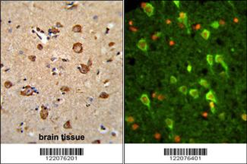 ANXA7 Antibody (Center)