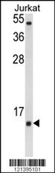 SOD1 Antibody (Center)