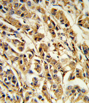 SREBF1 Antibody (Center)