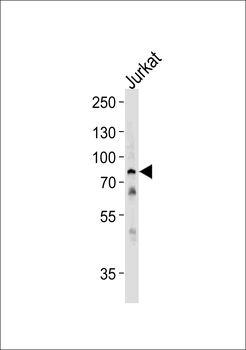HSPA6 Antibody (C-term)