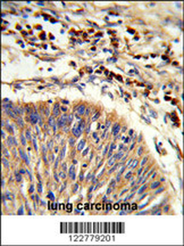 HSPA6 Antibody (C-term)