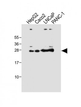 GSTA1 Antibody
