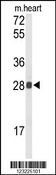 TSPAN1 Antibody (Center)