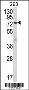 JAKMIP1 Antibody (Center)