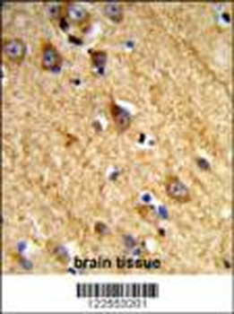 JAKMIP1 Antibody (Center)