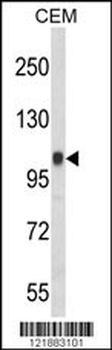 ITGB3 Antibody (C-term)