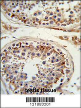 ITGB3 Antibody (C-term)