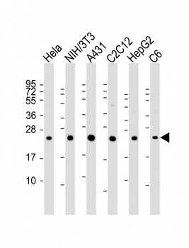 RAB7 Antibody (C-term)