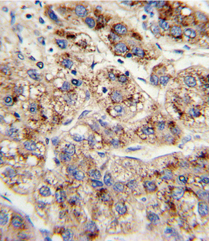 EHHADH Antibody (C-term)