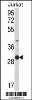 KLRC1 Antibody (C-term)