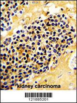 KLRC1 Antibody (C-term)
