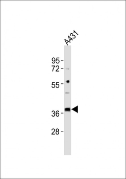 MICA Antibody (Center)