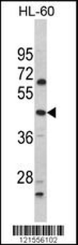 PTAR1 Antibody (Center)