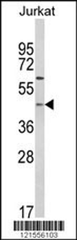 PTAR1 Antibody (Center)