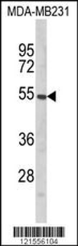 PTAR1 Antibody (Center)
