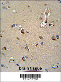 MPZ Antibody (C-term)
