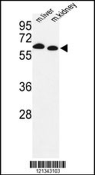 PRODH Antibody (Center)
