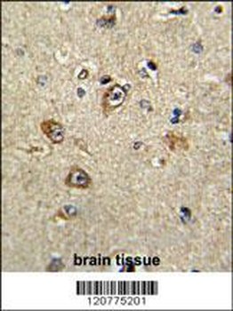 PTK2 Antibody (Center)