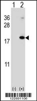 RNF5 Antibody (N-term)