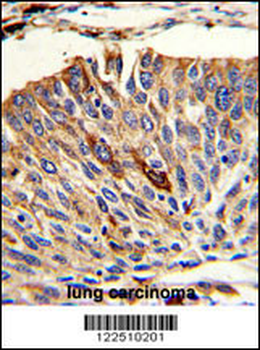 VTI1A Antibody (C-term)