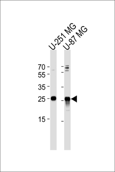 VTI1A Antibody (C-term)