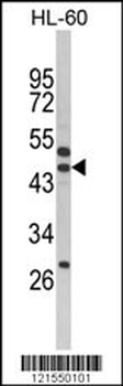 SERPINB7 Antibody (Center)