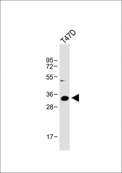 IGFBP2 Antibody (C-term)
