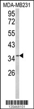 HSPC142 Antibody (Center)