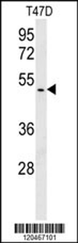 HSPC142 Antibody (N-term)