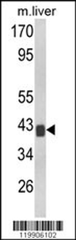 TOB1 Antibody (N-term)