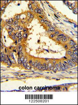 SCAP Antibody (Center)