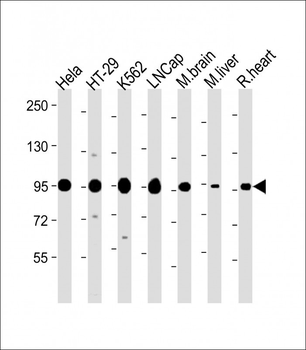 SCAP Antibody (Center)