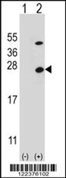 ATP5O Antibody (N-term)