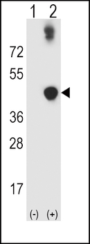 ADH5 Antibody (Center)