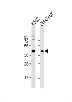 ADH5 Antibody (Center)