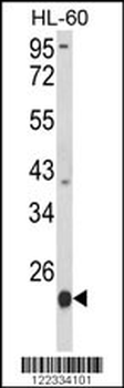 PSMB9 Antibody (C-term)