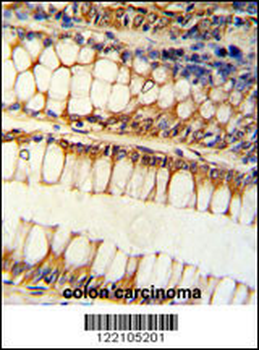 BCL2L11 Antibody (Center)